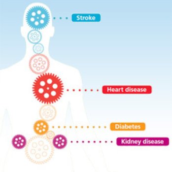 Diagram of a human body with coloured cogs - each part of the human body connected to a potential health problem.